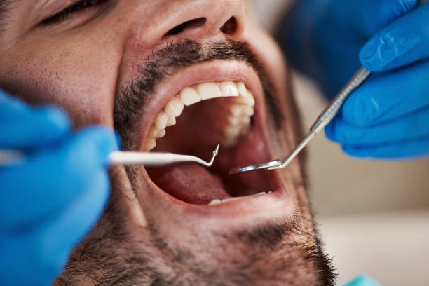 Best Urgent Tooth Repair  in Green River, WY