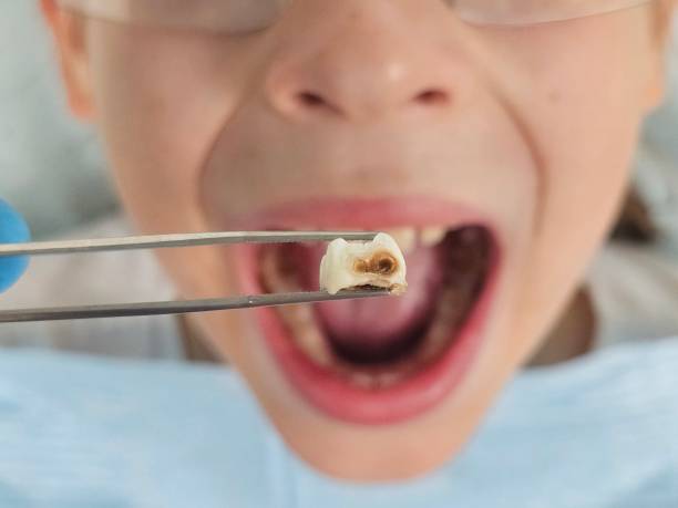 Best Tooth Pain Emergency Relief  in Green River, WY